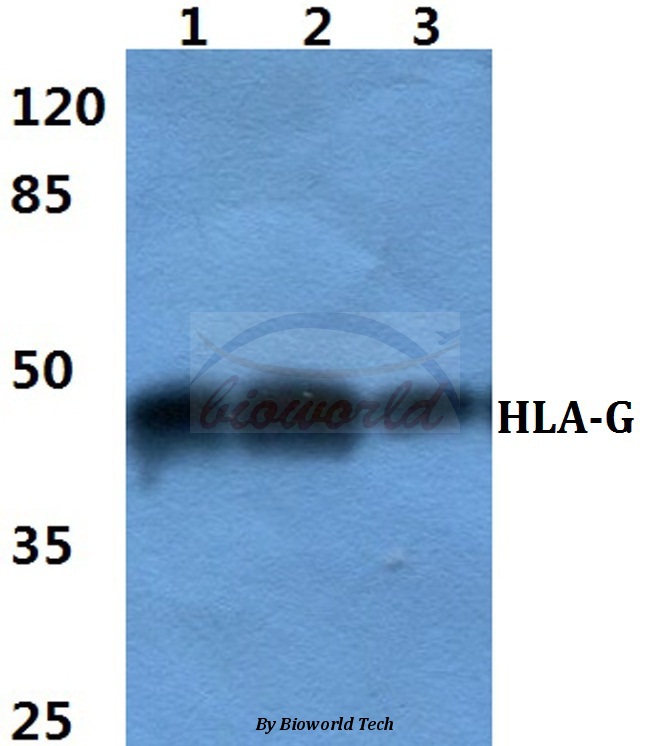Western blot (WB) analysis of HLA-G pAb at 1:500 dilution Lane1:HEK293T cell lysate Lane2:Raw264.7 cell lysate Lane3:PC12 cell lysate