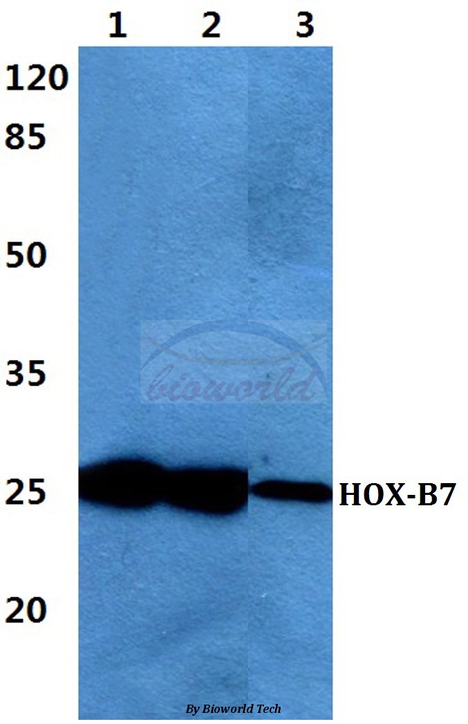Western blot (WB) analysis of HOX-B7 pAb at 1:500 dilution Lane1:Hela cell lysate Lane2:Raw264.7 cell lysate Lane3:H9C2 cell lysate