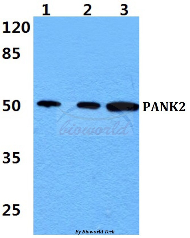 Western blot (WB) analysis of PANK2 pAb at 1:500 dilution Lane1:MCF-7 cell lysate Lane2:sp2/0 cell lysate Lane3:PC12 cell lysate