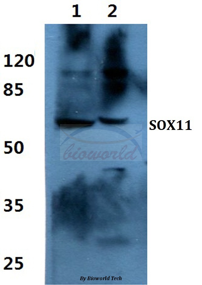 Western blot (WB) analysis of SOX11 pAb at 1:500 dilution Lane1:Hela cell lysate Lane2:sp2/0 cell lysate