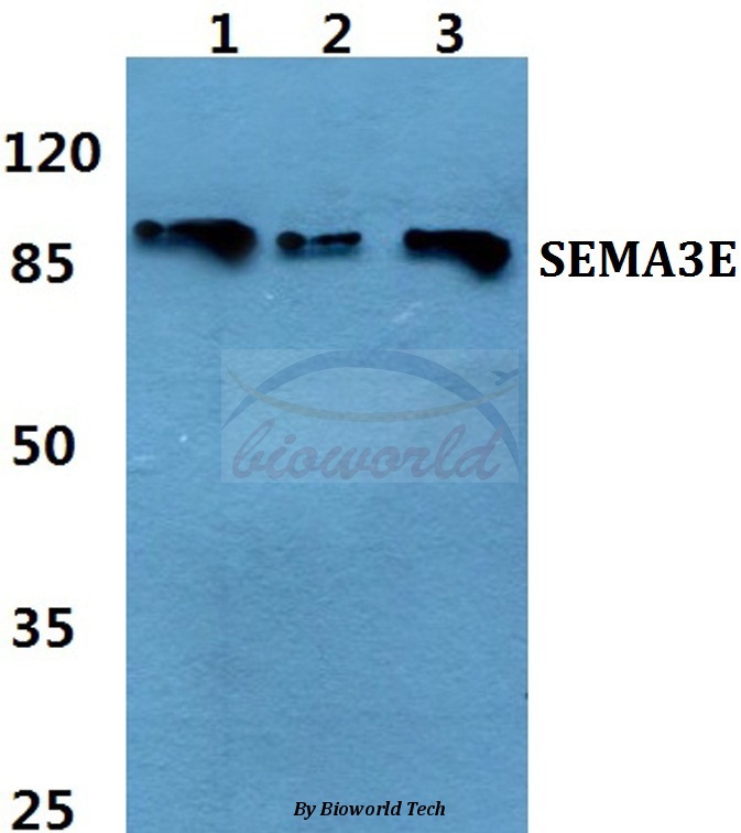 Western blot (WB) analysis of SEMA3E pAb at 1:500 dilution Lane1:A549 cell lysate Lane2:Mouse liver tissue lysate Lane3:Rat liver tissue lysate