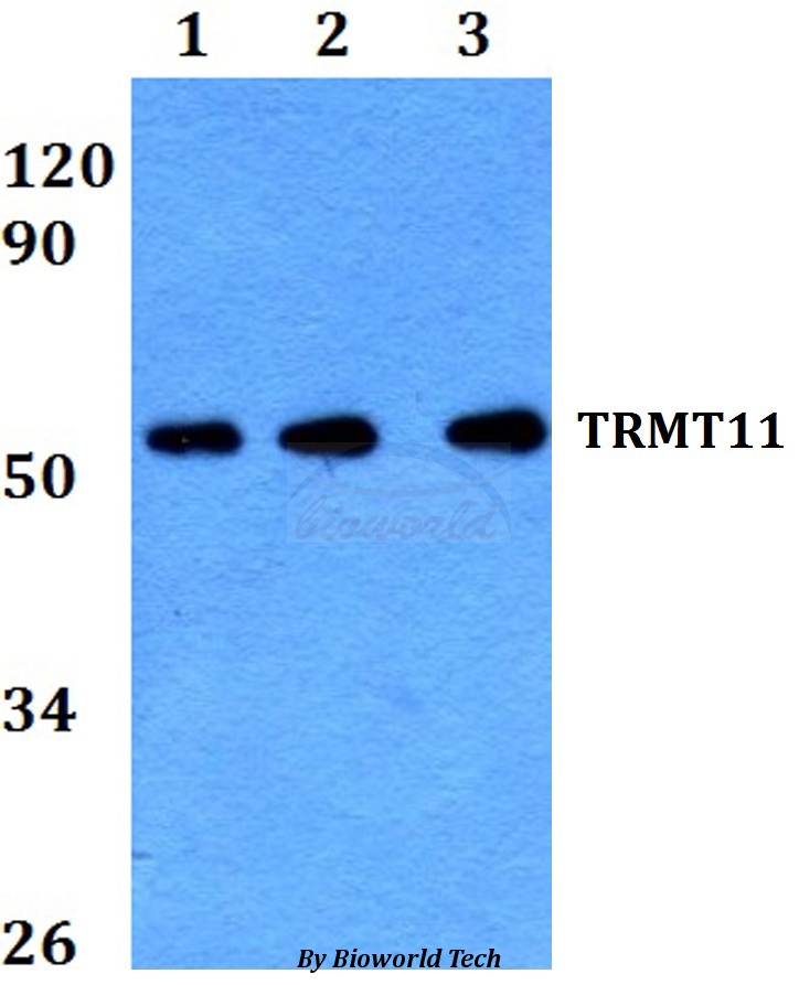 Western blot (WB) analysis of TRMT11 pAb at 1:500 dilution Lane1:HEK293T whole cell lysate Lane2:Raw264.7 whole cell lysate Lane3:PC12 whole cell lysate