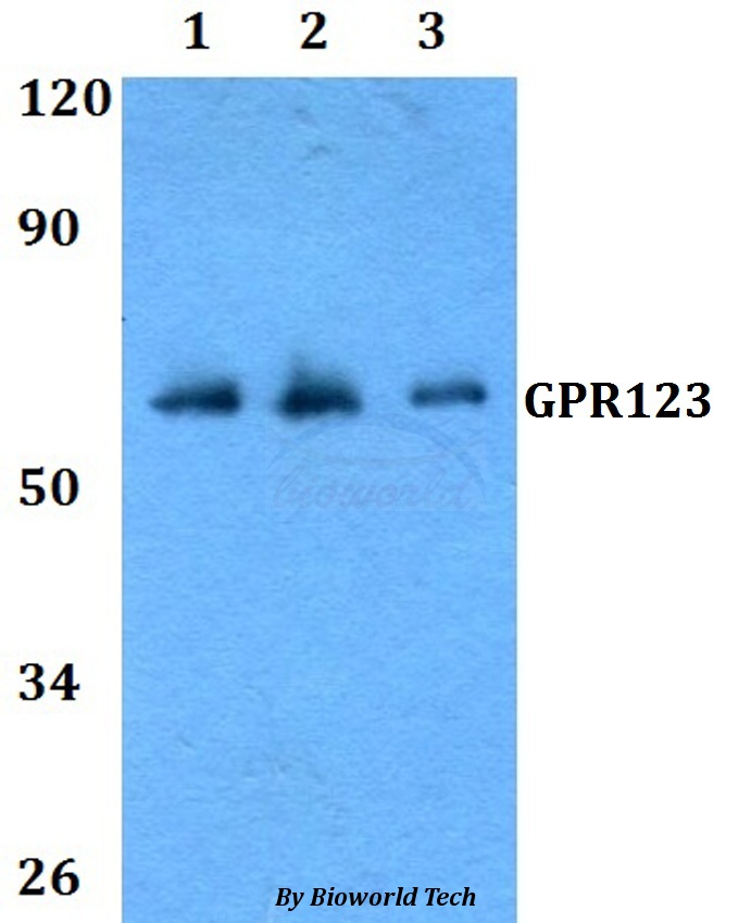 Western blot (WB) analysis of GPR123 pAb at 1:500 dilution Lane1:Hela whole cell lysate Lane2:Raw264.7 whole cell lysate Lane3:PC12 whole cell lysate