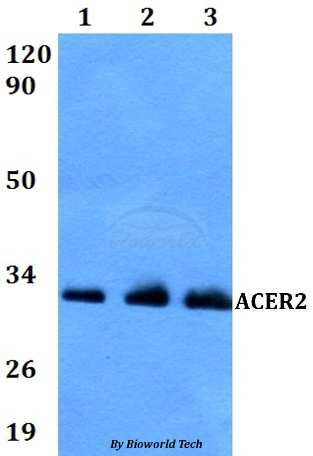 Western blot (WB) analysis of ACER2 pAb at 1:500 dilution Lane1:A549 whole cell lysate Lane2:MCF-7 whole cell lysate Lane3:PC12 whole cell lysate