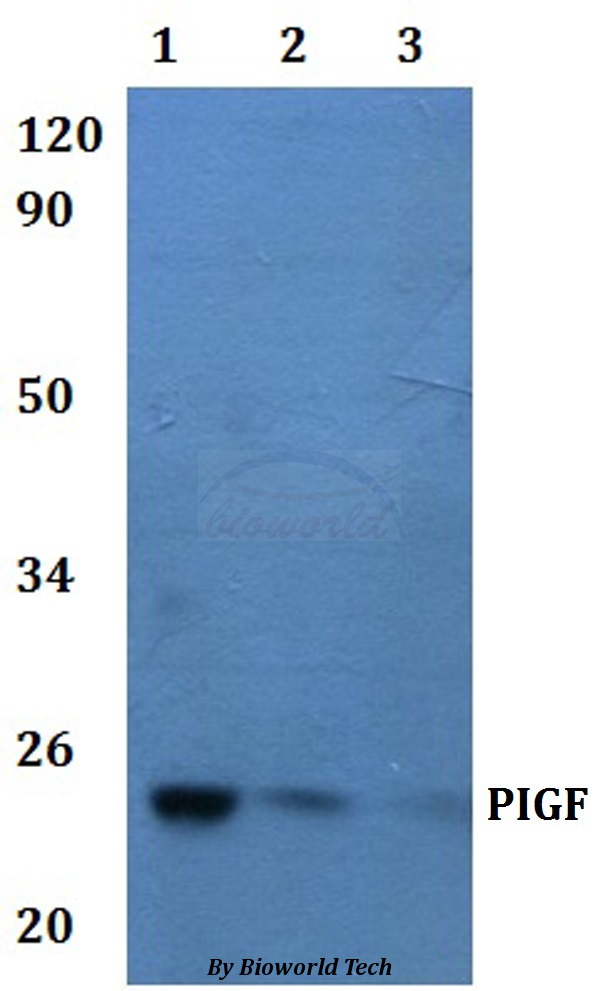 Western blot (WB) analysis of PIGF pAb at 1:500 dilution Lane1:HEK293T whole cell lysate Lane2:RAW264.7 whole cell lysate Lane3:H9C2 whole cell lysate