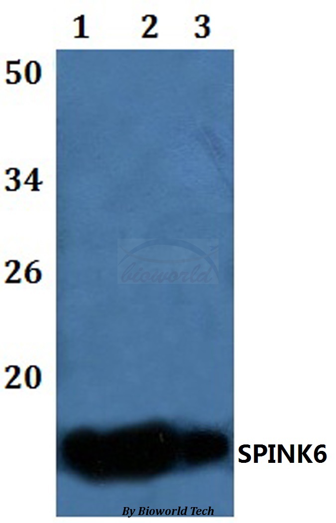 Western blot (WB) analysis of SPINK6 pAb at 1:500 dilution Lane1:Raw264.7 whole cell lysate Lane2:H9C2 whole cell lysate Lane3:HELA whole cell lysate