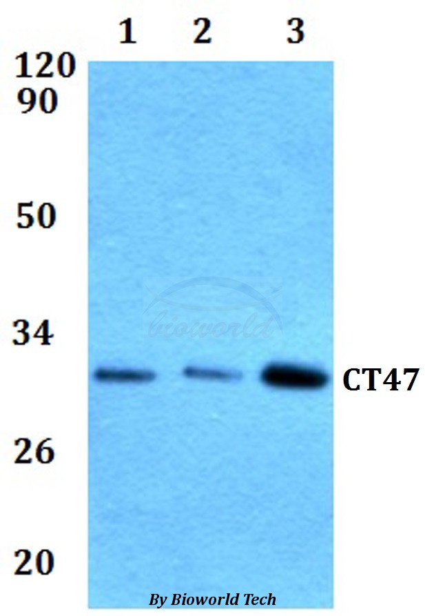 Western blot (WB) analysis of CT47 pAb at 1:500 dilution Lane1:HEK293T whole cell lysate Lane2:RAW264.7 whole cell lysate Lane3:PC12 whole cell lysate