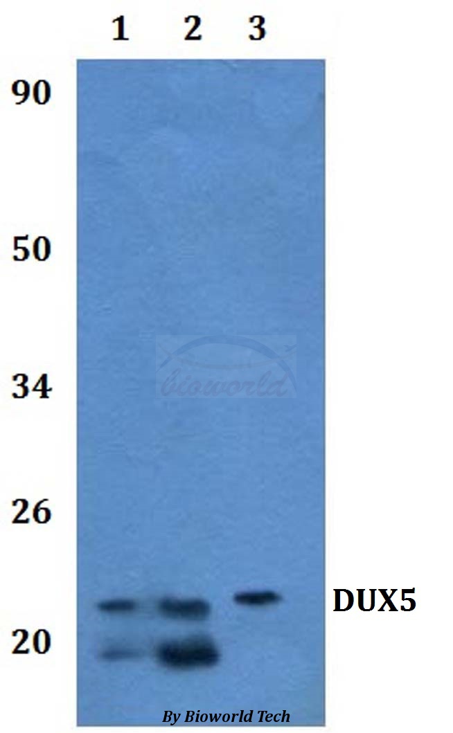 Western blot (WB) analysis of DUX5 pAb at 1:500 dilution Lane1:HEPG2 whole cell lysate Lane2:Raw264.7 whole cell lysate Lane3:H9C2 whole cell lysate