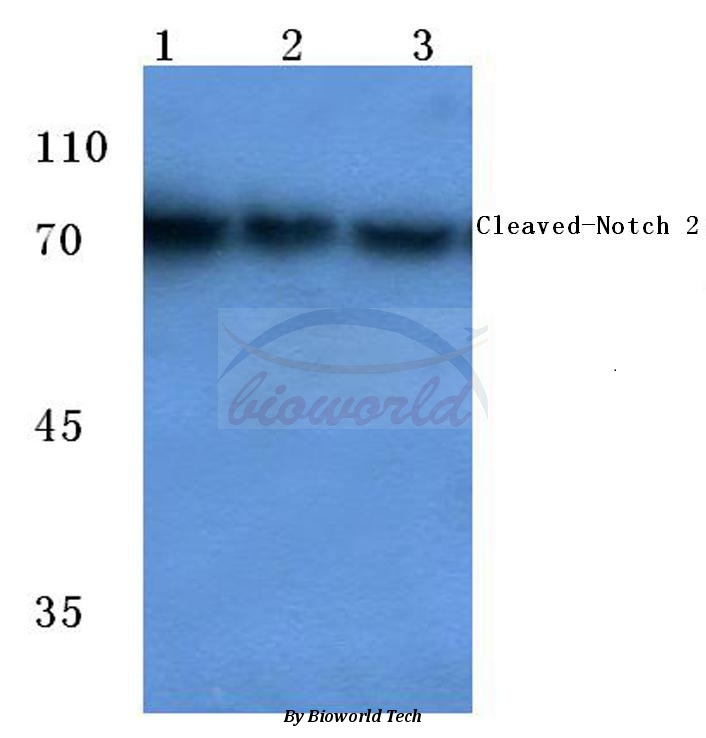 Western blot (WB) analysis of Cleaved-Notch 2 (D1733) pAb at 1:500 dilution Lane1:Hela cell lysate Lane2:MCF-7 cell lysate Lane3:Rat liver tissue lysate