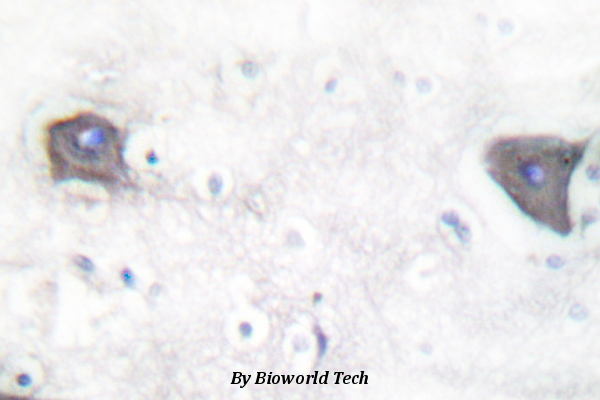 Immunohistochemistry (IHC) analyzes of Cleaved-Notch 1 (V1754) pAb in paraffin-embedded human brain tissue.