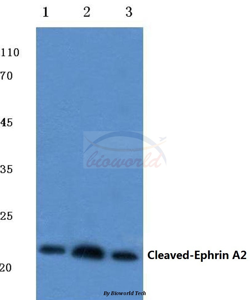Western blot (WB) analysis of Cleaved-Ephrin-A2 (N188) pAb at 1:500 dilution Lane1:HepG2 cell lysate Lane2:Mouse liver tissue lysate Lane3:Rat kidney tissue lysate