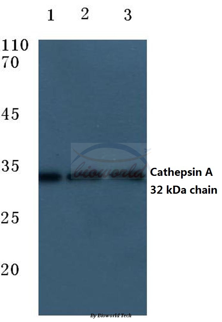 Western blot (WB) analysis of Cleaved-Cathepsin A (R326) pAb at 1:500 dilution Lane1:HepG2 cell lysate Lane2:Mouse kidney tissue lysate Lane3:Rat liver tissue lysate