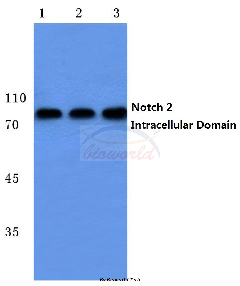 Western blot (WB) analysis of Cleaved-Notch 2 (A1734) pAb at 1:500 dilution Lane1:HepG2 cell lysate treated with colchicine Lane2:Raw264.7 cell lysate treated with colchicine Lane3:Rat liver tissue lysate