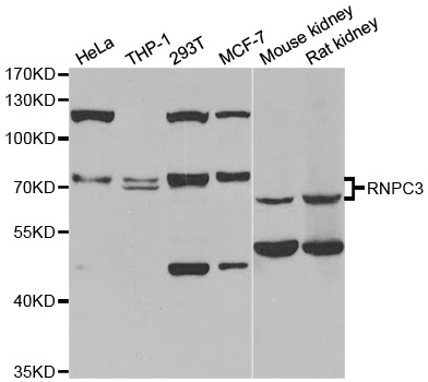 WesternBlot (WB) analysis of RNPC3 polyclonal antibody