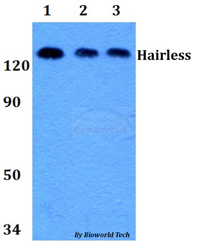 Western blot (WB) analysis of Hairless (E77) pAb at 1:500 dilution Lane1:HEK293T whole cell lysate Lane2:Raw264.7 whole cell lysate Lane3:PC12 whole cell lysate