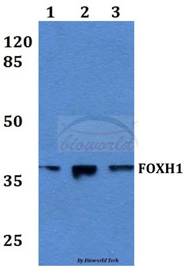 Western blot (WB) analysis of FOXH1 (Q19) pAb at 1:500 dilution Lane1:HEK293T whole cell lysate Lane2:sp2/0 whole cell lysate Lane3:NIH-3T3 whole cell lysate