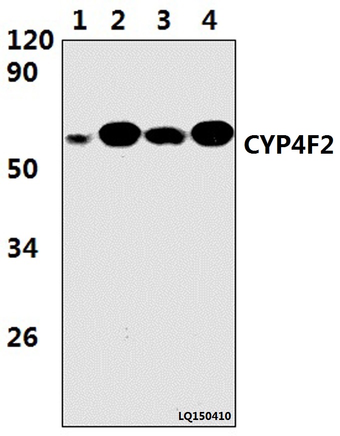 Western blot (WB) analysis of CYP4F2 pAb at 1:1000 dilution Lane1:HEPG2 whole cell lysate(55ug) Lane2:LO2 whole cell lysate(38ug) Lane3:The liver tissue lysate of Rat(41ug) Lane4:The liver tissue lysate of Mouse(38ug)