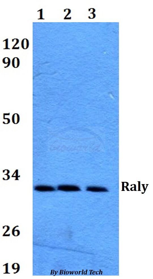 Western blot (WB) analysis of Raly (R103) pAb at 1:500 dilution Lane1:HEK293T whole cell lysate Lane2:Raw264.7 whole cell lysate Lane3:PC12 whole cell lysate