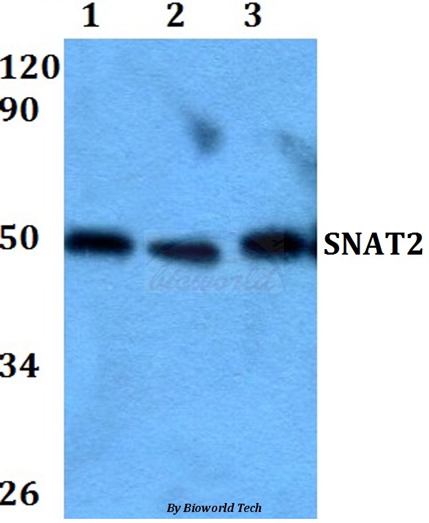 Western blot (WB) analysis of SNAT2 (W190) pAb at 1:500 dilution Lane1:HEK293T whole cell lysate Lane2:Raw264.7 whole cell lysate Lane3:PC12 whole cell lysate