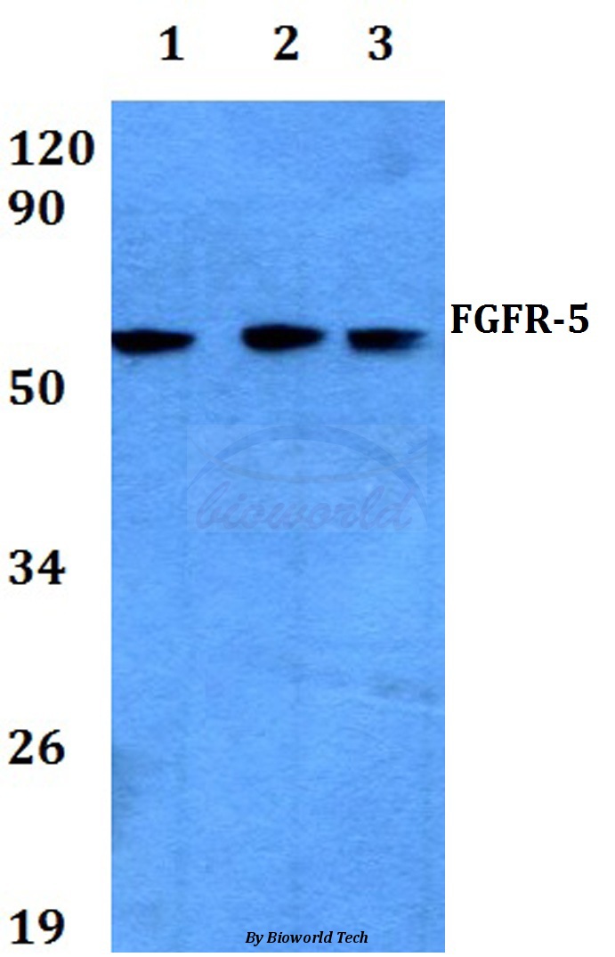 Western blot (WB) analysis of FGFR-5 (L191) pAb at 1:500 dilution Lane1:HEK293T whole cell lysate Lane2:sp2/0 whole cell lysate Lane3:H9C2 whole cell lysate