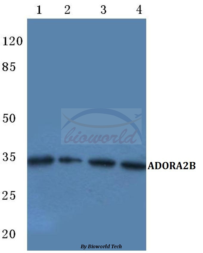Western blot (WB) analysis of ADORA2B (W270) pAb at 1:500 dilution Lane1:HEK293T cell lysate Lane2:NIH-3T3 cell lysate Lane3:PC12 cell lysate Lane4:Rat kidney tissue lysate