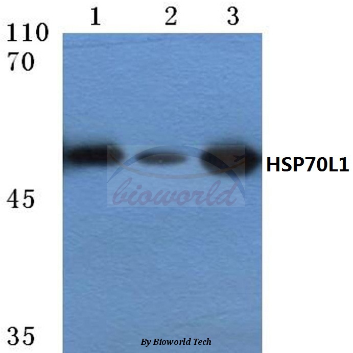 Western blot (WB) analysis of HSP70L1 (E445) pAb at 1:500 dilution Lane1:HEK293T cell lysate Lane2:Mouse Kidney tissue lysate Lane3:Rat Kidney tissue lysate