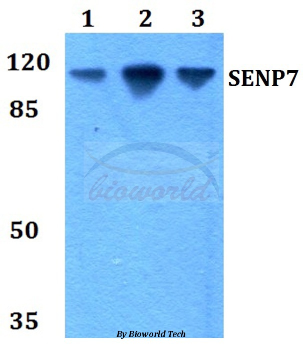 Western blot (WB) analysis of SENP7 (R957) pAb at 1:500 dilution Lane1:HEK293T whole cell lysate Lane2:Raw264.7 whole cell lysate Lane3:PC12 whole cell lysate