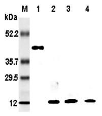 WB anti-Resistin (rat)<br/>Western blot analysis of resistin using anti-Resistin (rat), mAb (RRES 03) mab10014 at 1:5'000 dilution.<br/>1: Rat resistin:Fc fusion protein.<br/>2: Recombinant rat resistin protein (His-tagged).<br/>3: Recombinant human resis