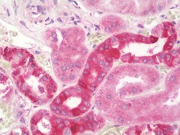 Anti-HSD2 / HSD11B2 antibody IHC staining of human kidney. Immunohistochemistry of formalin-fixed, paraffin-embedded tissue after heat-induced antigen retrieval. Antibody dilution 1:100.