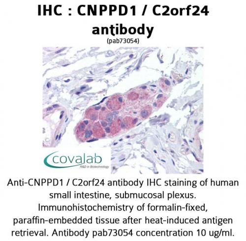 IHC : CNPPD1 / C2orf24 antibody<br/>(pab73054)<br/>Anti-CNPPD1 / C2orf24 antibody IHC of human small intestine, submucosal plexus. Immunohistochemistry of formalin-fixed, paraffin-embedded tissue after heat-induced antigen retrieval. Antibody concentratio