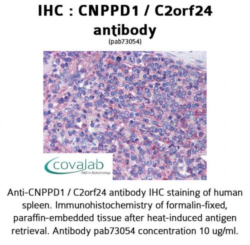 IHC : CNPPD1 / C2orf24 antibody<br/>(pab73054)<br/>Anti-CNPPD1 / C2orf24 antibody IHC of human spleen. Immunohistochemistry of formalin-fixed, paraffin-embedded tissue after heat-induced antigen retrieval. Antibody concentration 10 µg/ml.