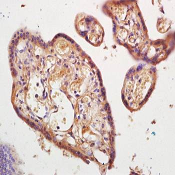 Immunohistochemical analysis of formalin-fixed and paraffin embedded human placenta tissue (Dilution at:1:200) using SCN11A antibody 