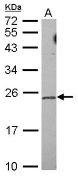 Western Blot analysis of A:U87MG whole cell lysate using TRF4 2 antibody 