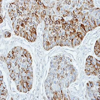  Immunohistochemical analysis of formalin-fixed and paraffin-embedded SCC xenograft using TRF4 2 antibody