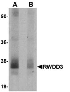 Western blot analysis of mouse kidney tissue lysate at 0.5 ug/mL in (A) the absence and (B) the presence of blocking peptide using RWDD3 antibody