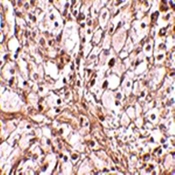  Immunohistochemical analysis of formalin-fixed and paraffin-embedded mouse ovary tissue at 10 ug/mL using TRIM30 antibody