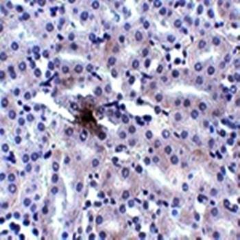  Immunohistochemical analysis of formalin-fixed and paraffin-embedded mouse kidney tissue at 2.5 ug/mL using ZIP11 antibody