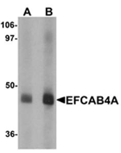 Western blot analysis of human lung tissue lysate at (A) 1 and (B) 2 ug/mL using EFCAB4A antibody