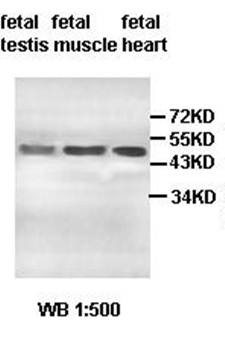 Western blot analysis of fetal testis,muscle and heart lysate using ACPT antibody 