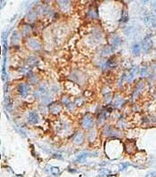  Immunohistochemical analysis of formalin-fixed paraffin embedded fetal testis showing membrane staining using ACPT antibody