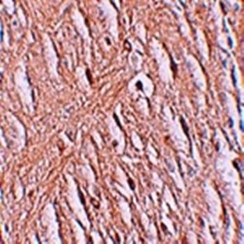 Immunohistochemical analysis of formalin-fixed and paraffin-embedded human brain tissue at 2.5 ug/mL using ZIP9 antibody