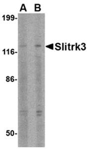 Western blot analysis of SK-N-SH cell lysate at (A) 0.5 and (B) 1 ug/mL using Slitrk3 antibody 