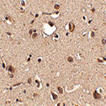  Immunohistochemical analysis of formalin-fixed and paraffin-embedded human brain tissue at 2.5 ug/mL using Slitrk3 antibody