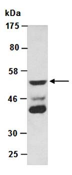 Western blot analysis of recombinant mouse GMCSF protein(A:10ng,B:100ng) using GMCSF antibody
