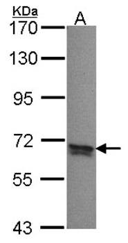 Western Blot analysis of A:A431 whole cell lysate using PPP2R5B antibody