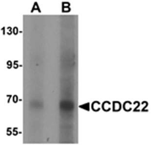 Western blot analysis of 293 cell lysate at (A) 1 and (B) 2 ug/mL using CCDC22 antibody