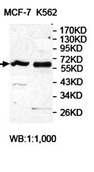 Western blot analysis of MCF-7 and K562 cell lysate using ANGEL2 antibody