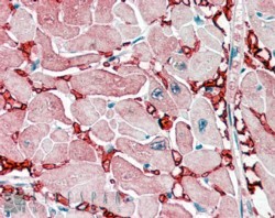  orb19708 (2.5ug/ml) staining of paraffin embedded Human Heart. Steamed antigen retrieval with citrate buffer pH 6, AP-staining.