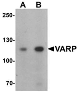 Western blot analysis of K562 cell lysate at (A) 1 and (B) 2 ug/mL using VARP antibody