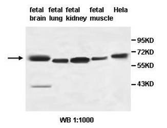  Western blot analysis of fetal brain,lung,kidney,muscle and Hela cell lysate using AHCYL2 antibody